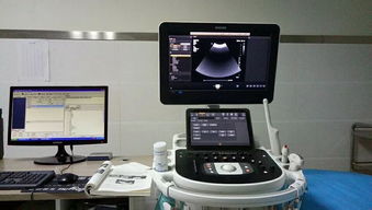 旬陽縣醫(yī)院成功引進(jìn)先進(jìn)超聲設(shè)備，正式開通新生兒顱腦超聲檢查服務(wù)